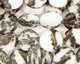 Mexican Zebra Jasper Puff Coin 12mm